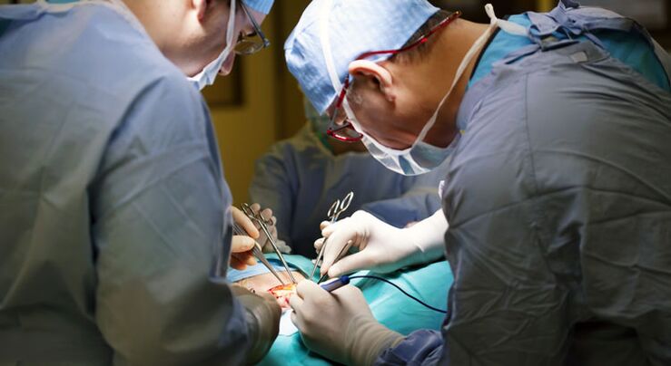La cirugía se realiza en estadios avanzados de prostatitis crónica en hombres.